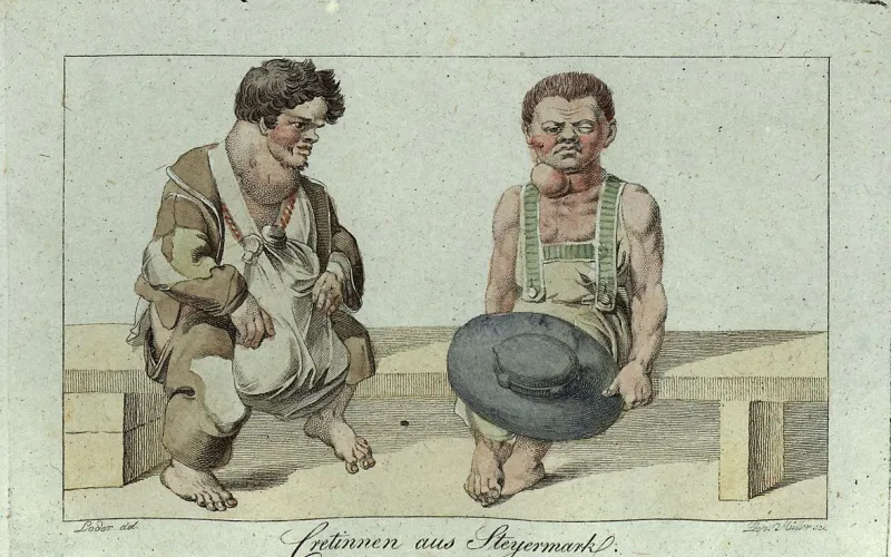La fabrique du « crétin des Alpes » 
